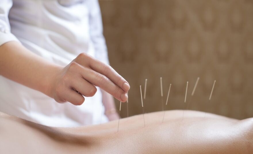 acupunctuur