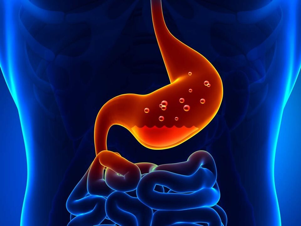 Gastritis is een ontstekingsziekte van de maag waarvoor een dieet nodig is